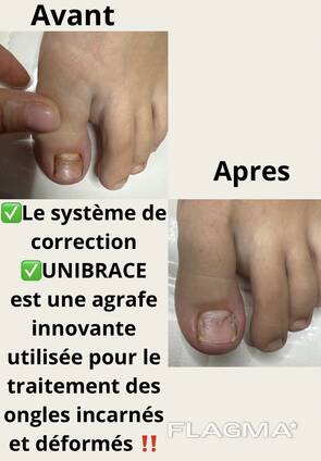 Маникюр- педикюр специализация в подологии