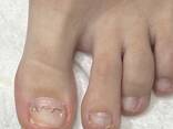 Маникюр- педикюр специализация в подологии - фото 8